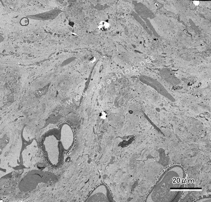 カラスのフンの電子顕微鏡画像