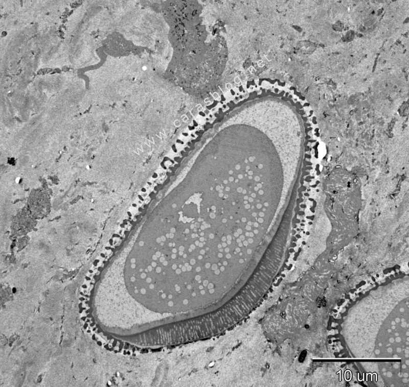カラスのフンの中にあった花粉