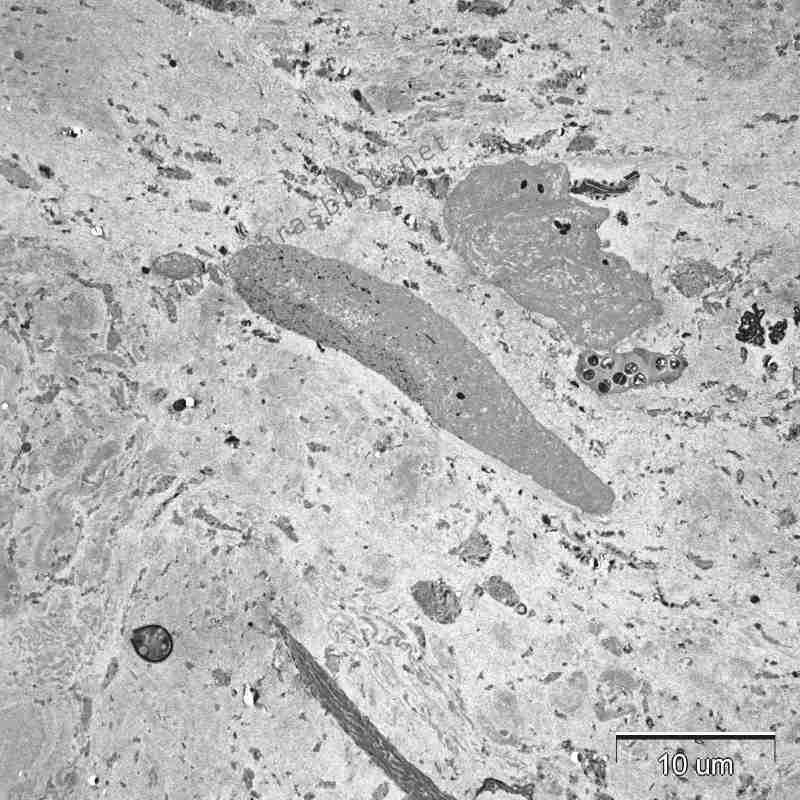 カラスのフンの電子顕微鏡画像