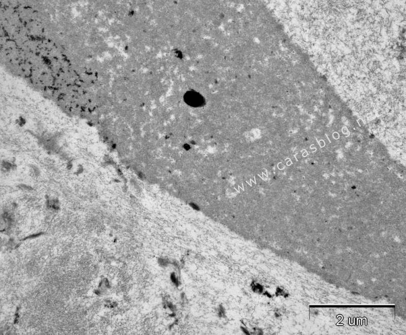 カラスのフンに含まれる自らの羽毛