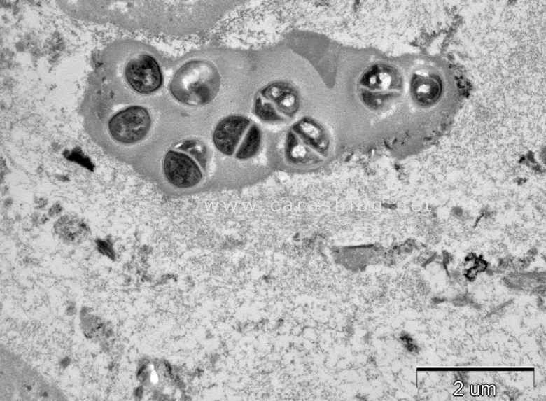 カラスのフンに含まれる球菌