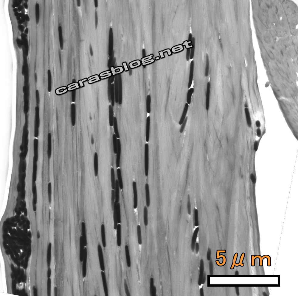 カラスの羽の透過型電子顕微鏡画像
