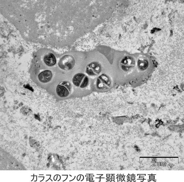 カラスのフンの電子顕微鏡画像