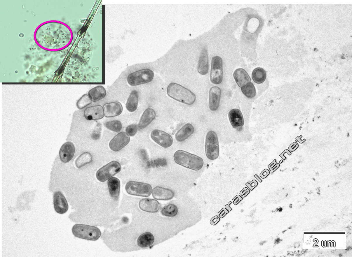 カラスのフンの電子顕微鏡写真