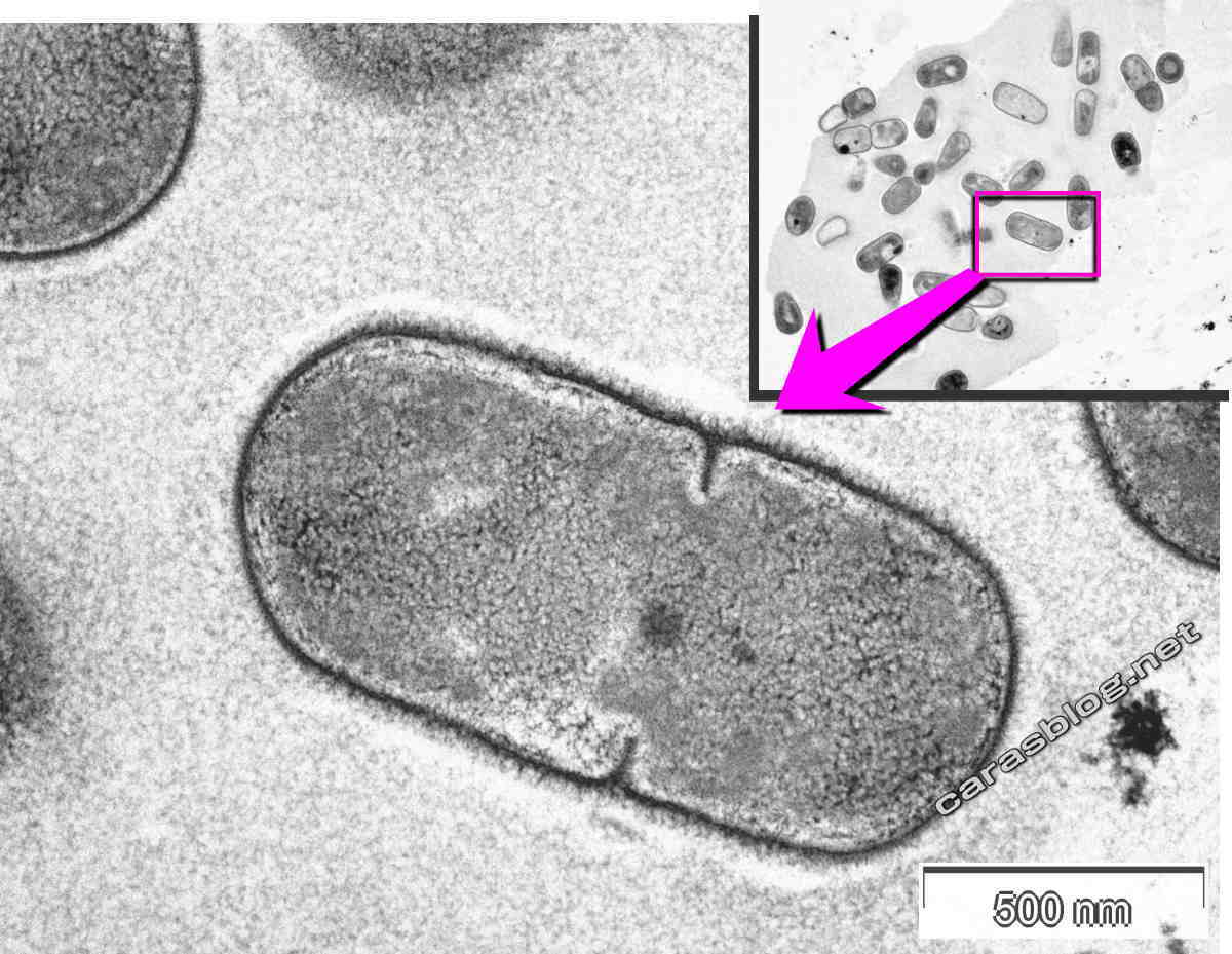 カラスのフンの電子顕微鏡写真