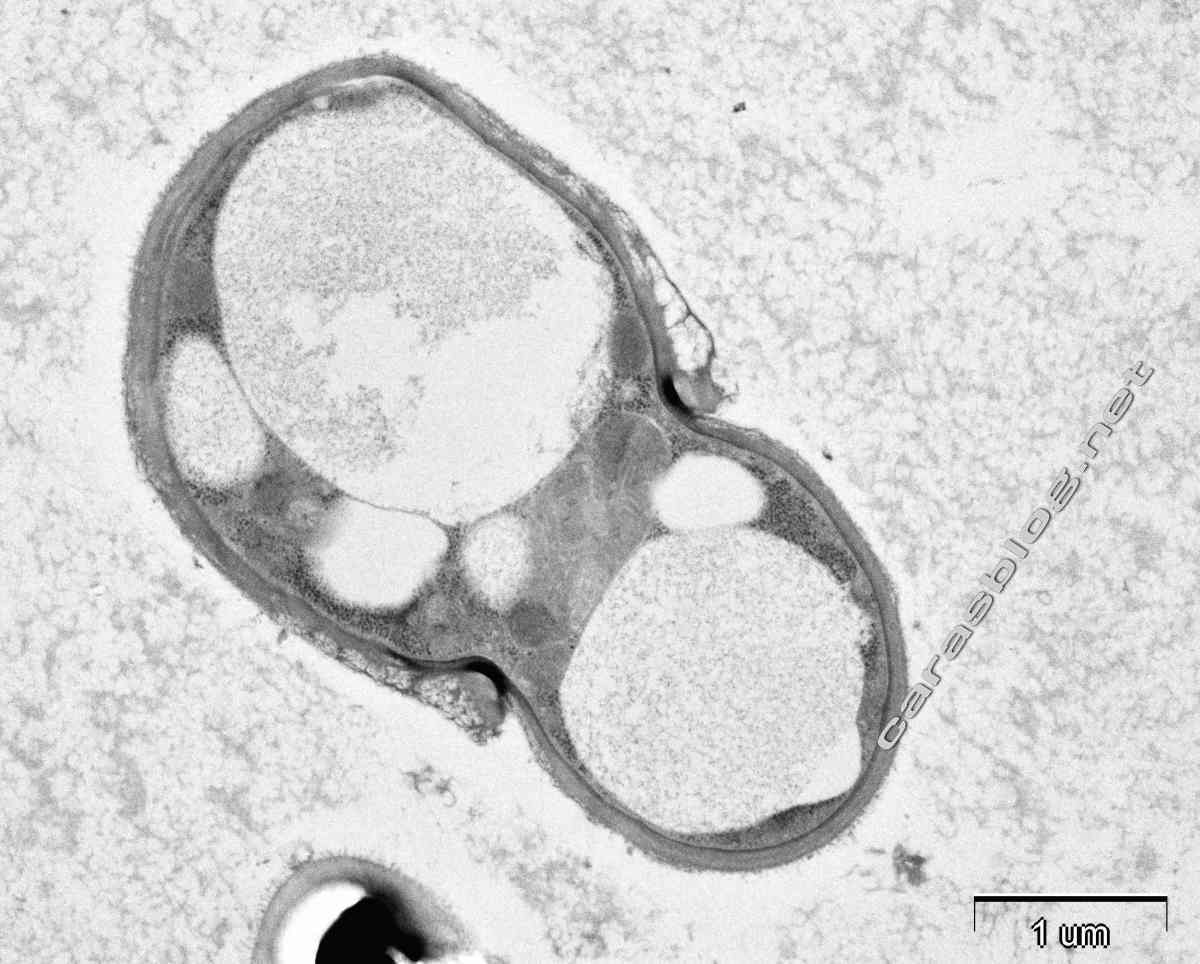 カラスのフンの電子顕微鏡写真
