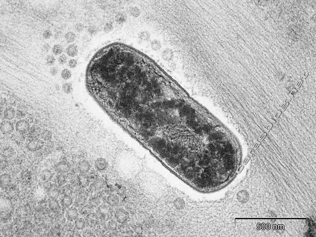 カラスのフンの電子顕微鏡写真