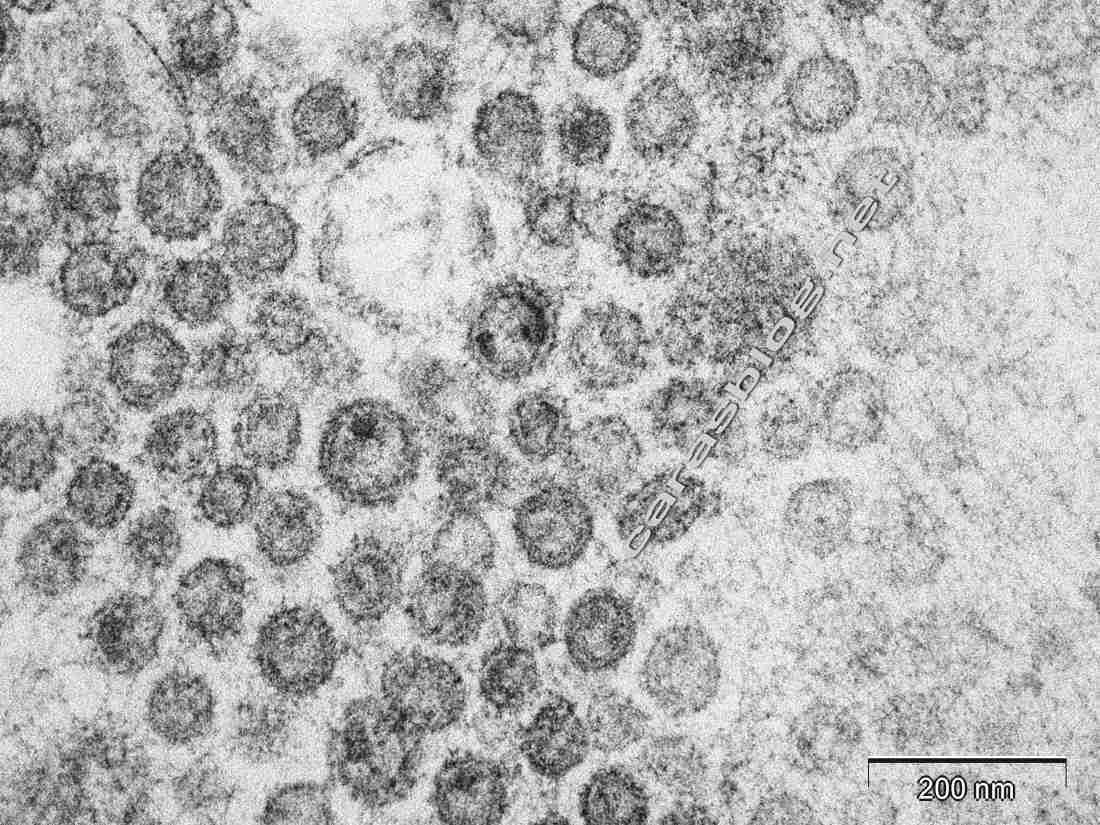 カラスのフンの電子顕微鏡写真