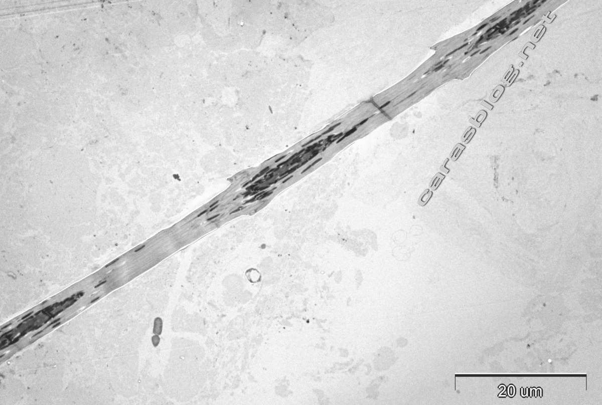 カラスの羽毛の電子顕微鏡写真