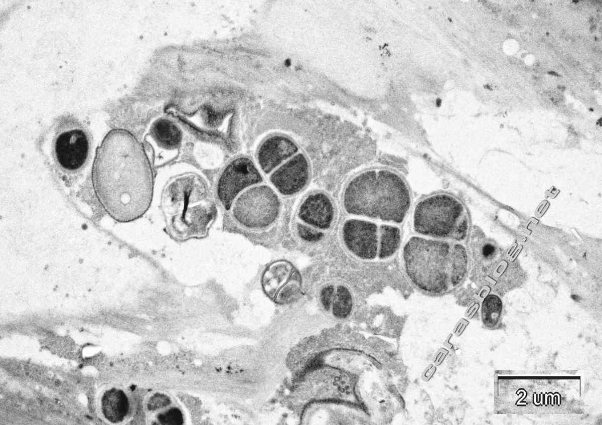 カラスのフンの電子顕微鏡写真