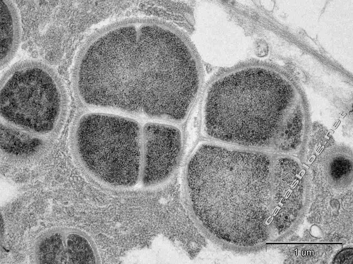 カラスのフンの電子顕微鏡写真