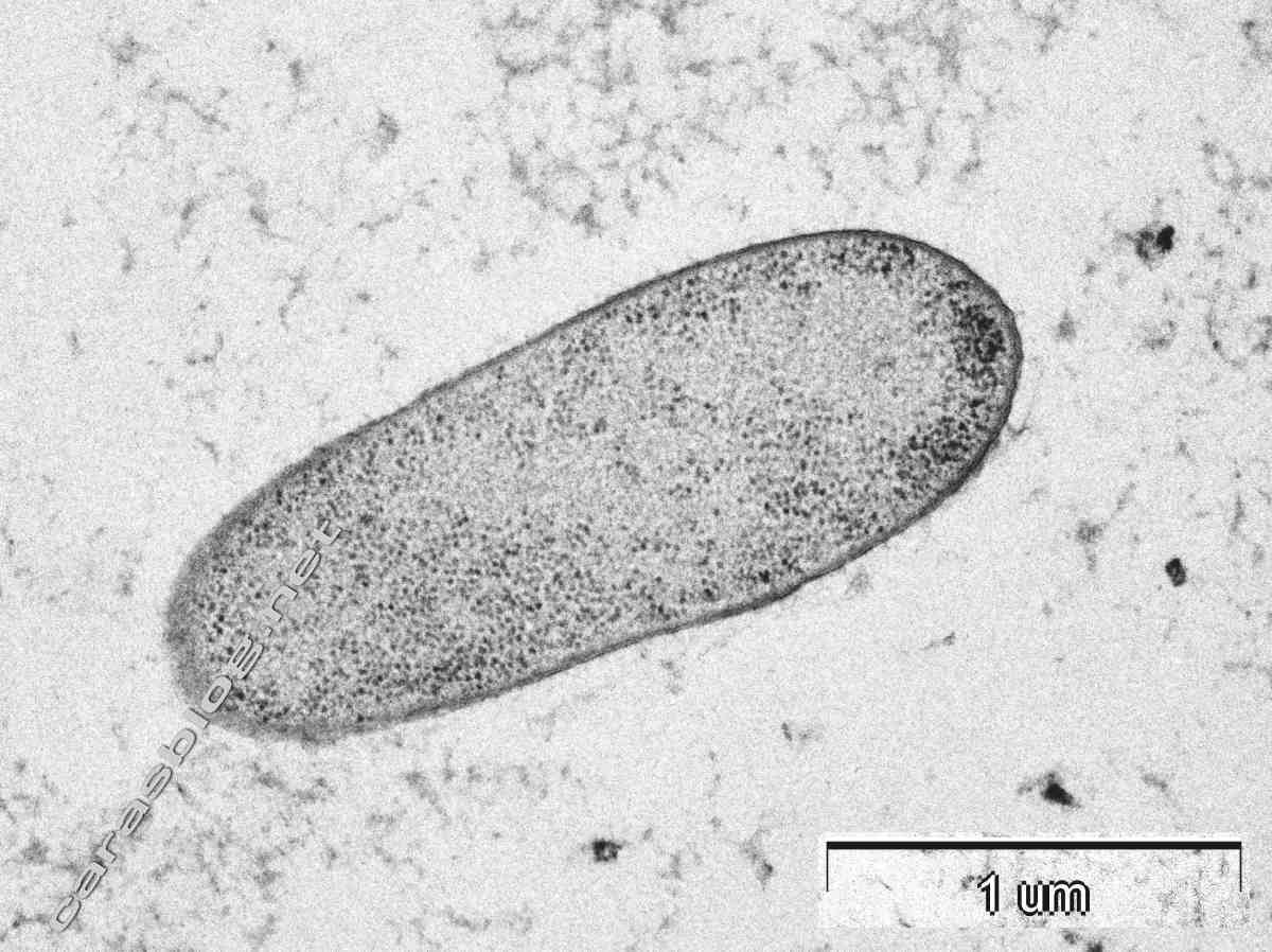 カラスのフンの電子顕微鏡写真