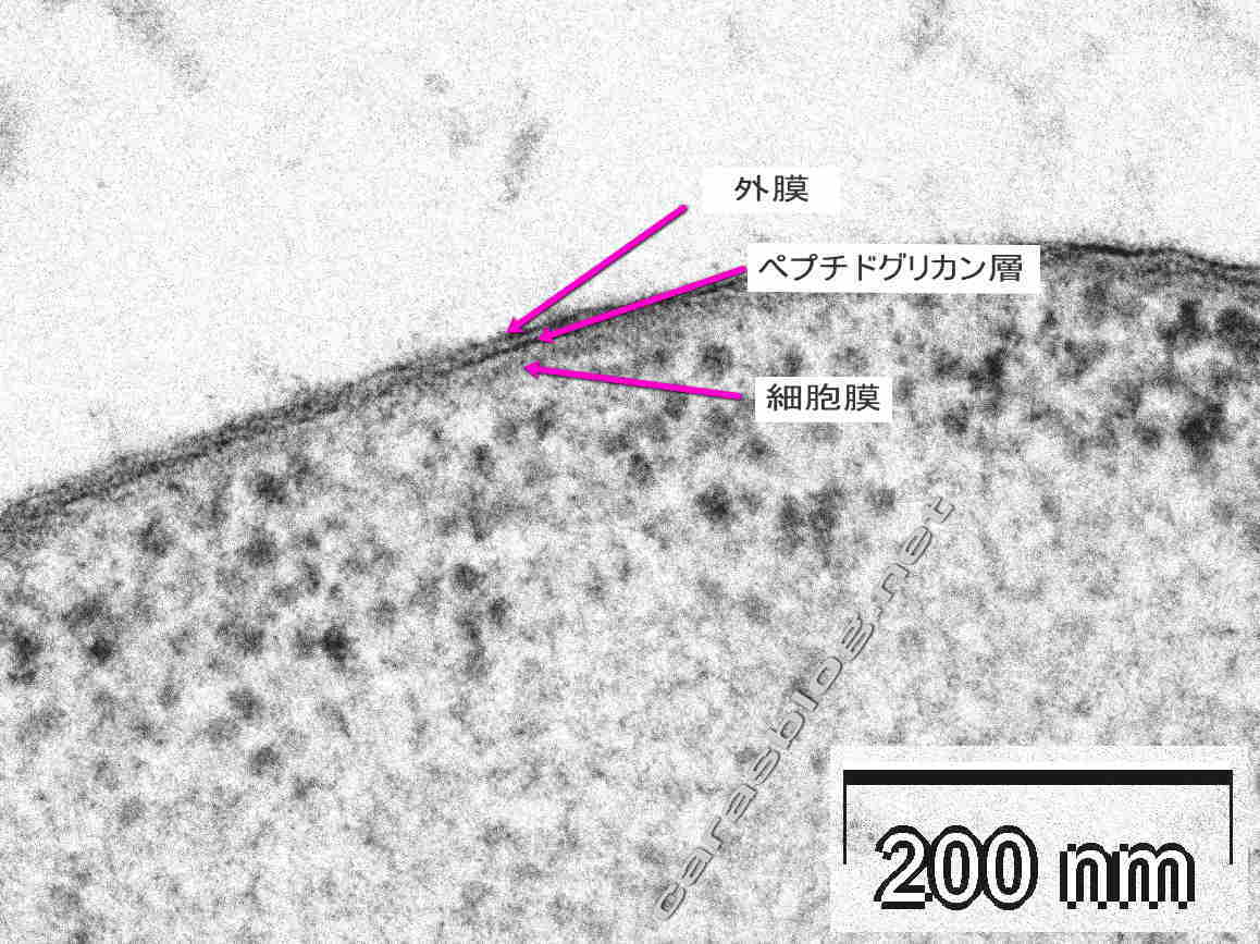 カラスのフンの電子顕微鏡写真