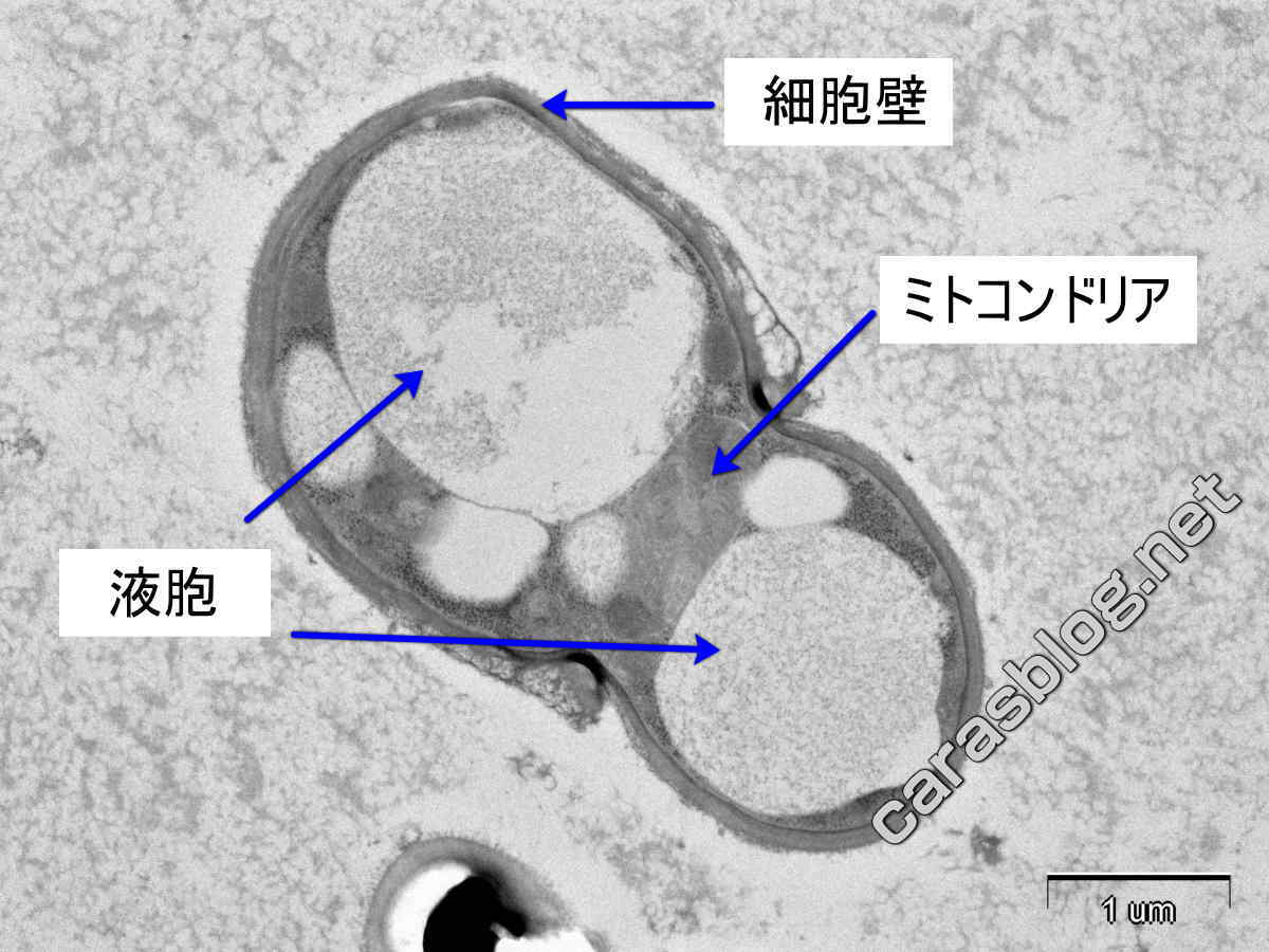 カラスのフンの電子顕微鏡写真