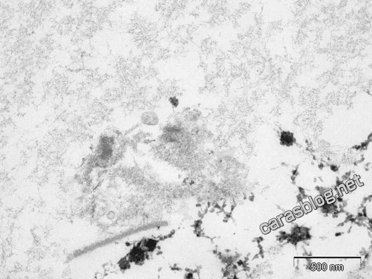 カラスのフンの電子顕微鏡写真
