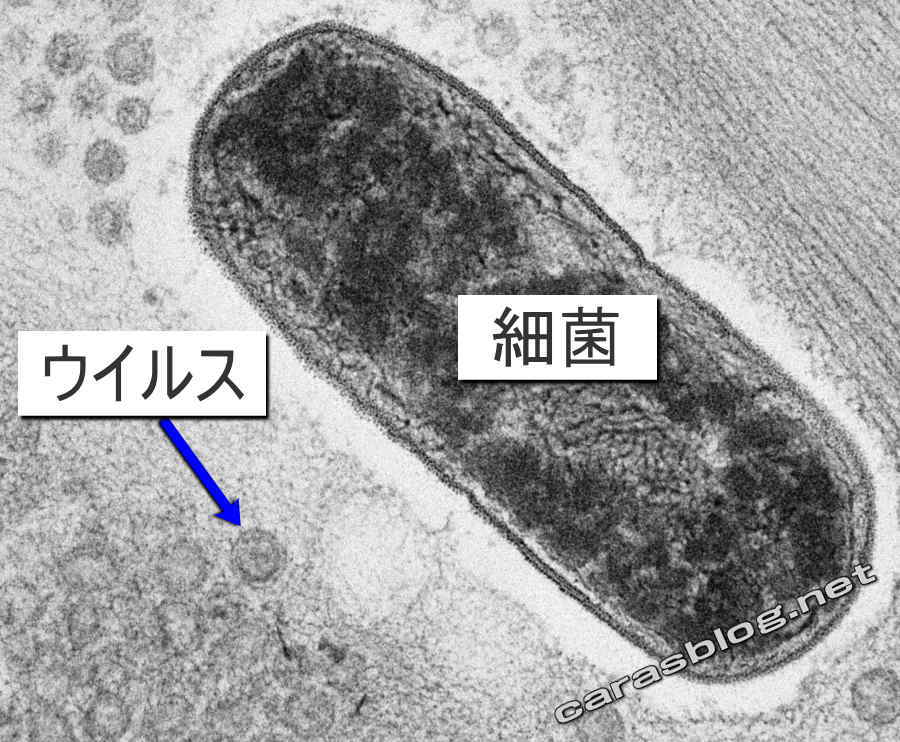 カラスのフンの電子顕微鏡写真