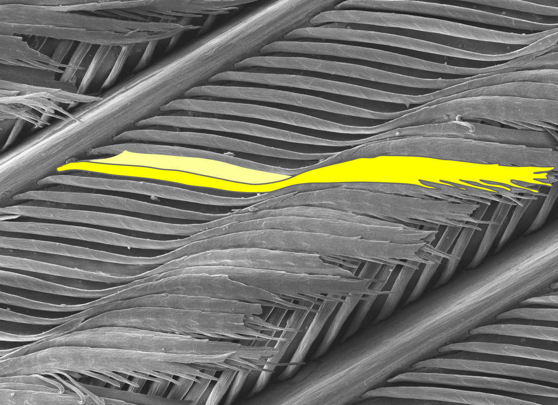 走査型電子顕微鏡写真